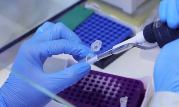 Bahia registra mais um caso de varíola dos macacosv